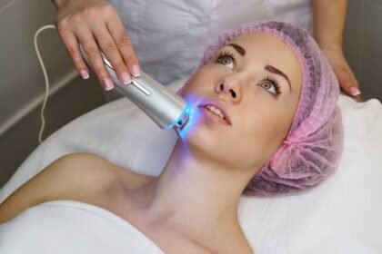 q-switch laser treatment